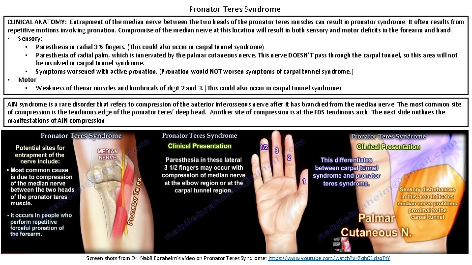 Pronator Teres Syndrome CLINICAL ANATOMY: Entrapment of the median nerve between the two heads