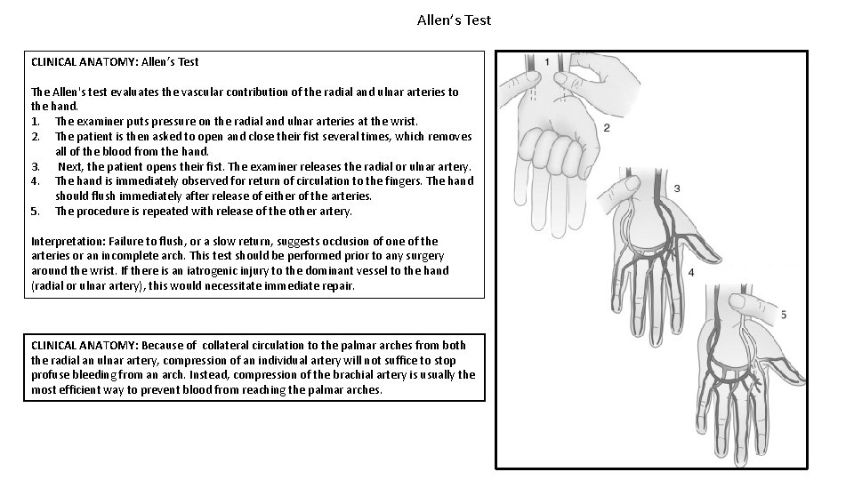 Allen’s Test CLINICAL ANATOMY: Allen’s Test The Allen's test evaluates the vascular contribution of