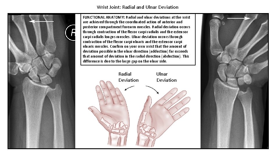 Wrist Joint: Radial and Ulnar Deviation FUNCTIONAL ANATOMY: Radial and ulnar deviations at the