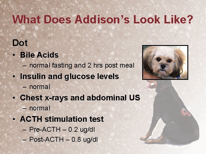What Does Addison’s Look Like? Dot • Bile Acids – normal fasting and 2