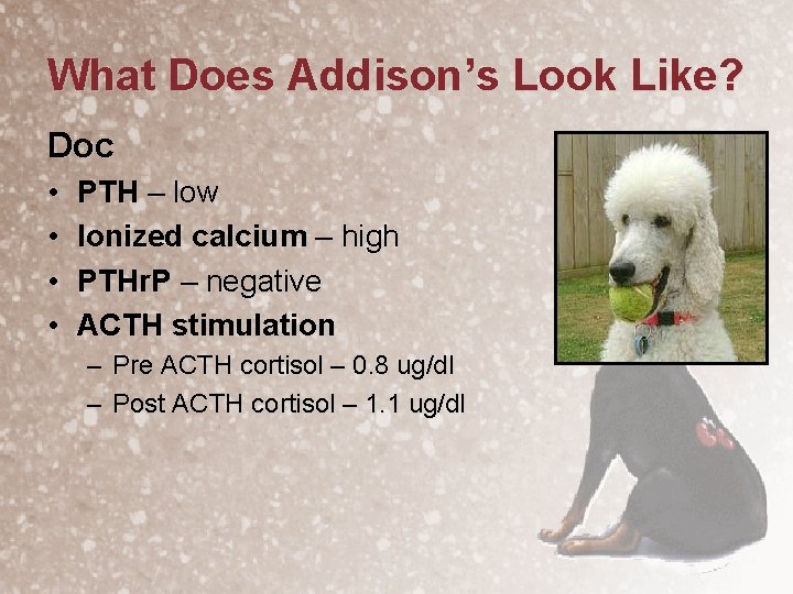 What Does Addison’s Look Like? Doc • • PTH – low Ionized calcium –