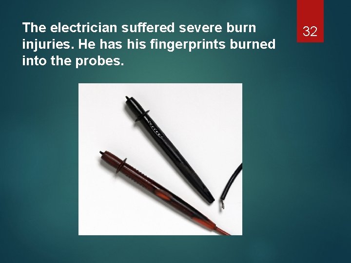 The electrician suffered severe burn injuries. He has his fingerprints burned into the probes.