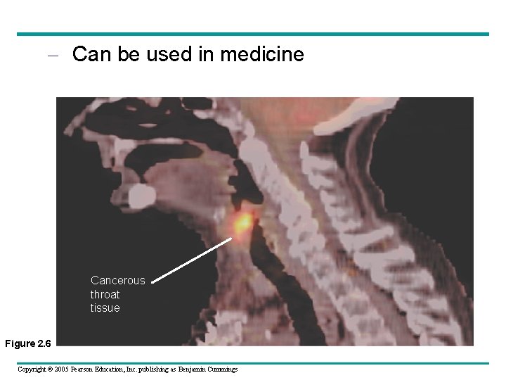 – Can be used in medicine Cancerous throat tissue Figure 2. 6 Copyright ©
