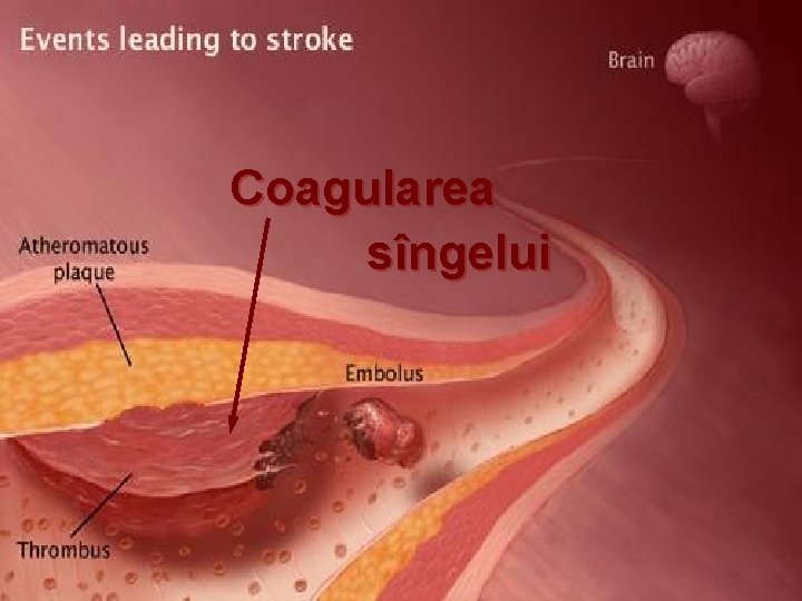 Coagularea sîngelui 