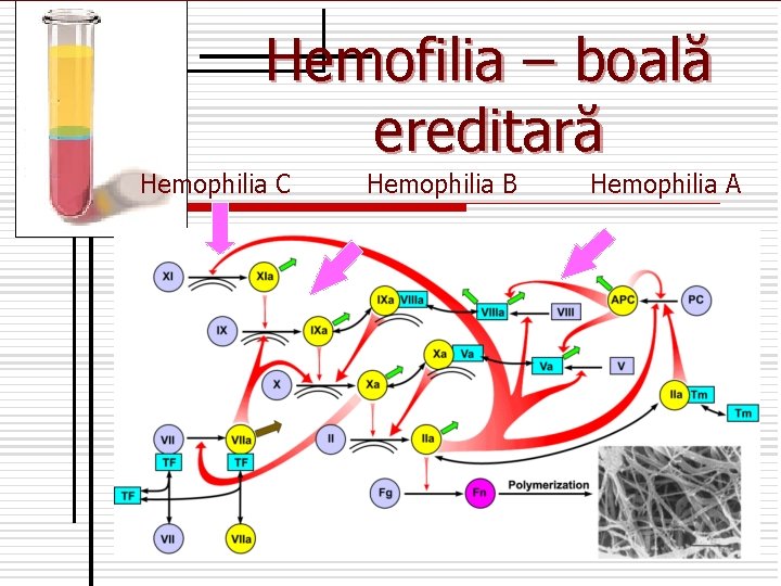 Hemofilia – boală ereditară Hemophilia C Hemophilia B Hemophilia A 