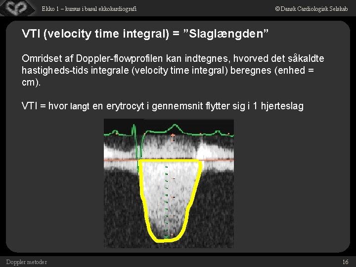 Ekko 1 – kursus i basal ekkokardiografi © Dansk Cardiologisk Selskab VTI (velocity time