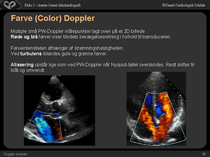 Ekko 1 – kursus i basal ekkokardiografi © Dansk Cardiologisk Selskab Farve (Color) Doppler