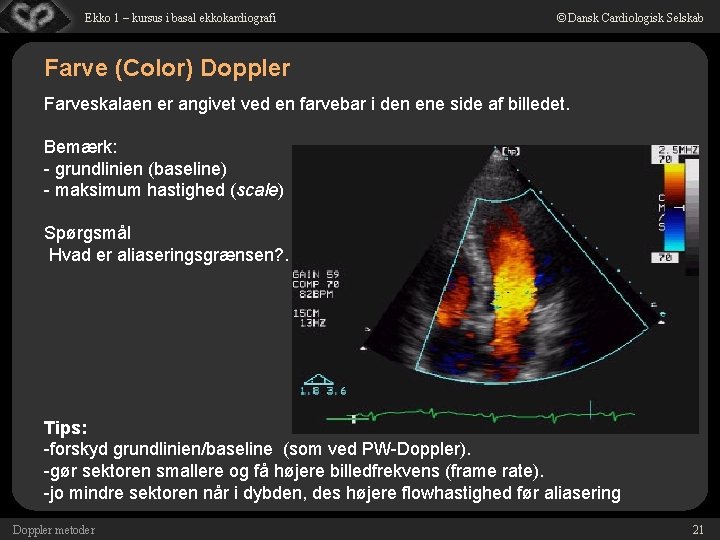 Ekko 1 – kursus i basal ekkokardiografi © Dansk Cardiologisk Selskab Farve (Color) Doppler