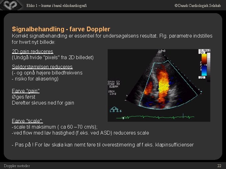 Ekko 1 – kursus i basal ekkokardiografi © Dansk Cardiologisk Selskab Signalbehandling - farve