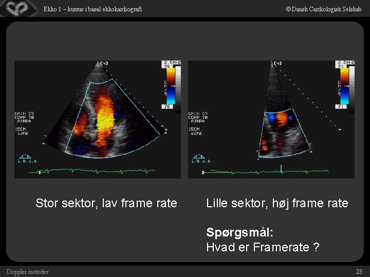 Ekko 1 – kursus i basal ekkokardiografi Stor sektor, lav frame rate © Dansk