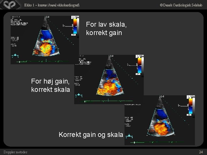 © Dansk Cardiologisk Selskab Ekko 1 – kursus i basal ekkokardiografi For lav skala,