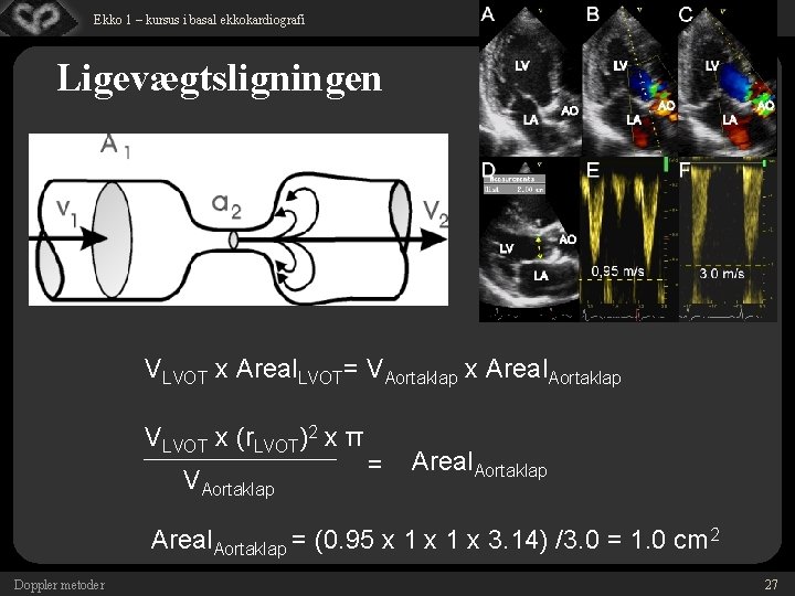 © Dansk Cardiologisk Selskab Ekko 1 – kursus i basal ekkokardiografi Ligevægtsligningen VLVOT x