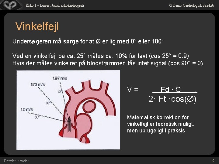 © Dansk Cardiologisk Selskab Ekko 1 – kursus i basal ekkokardiografi Vinkelfejl Undersøgeren må
