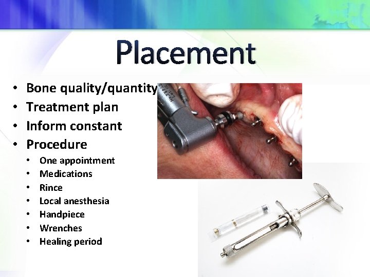 Placement • • Bone quality/quantity Treatment plan Inform constant Procedure • • One appointment