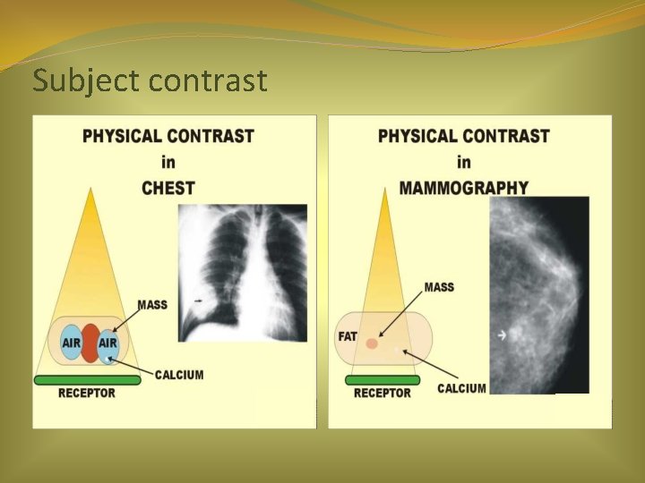 Subject contrast 