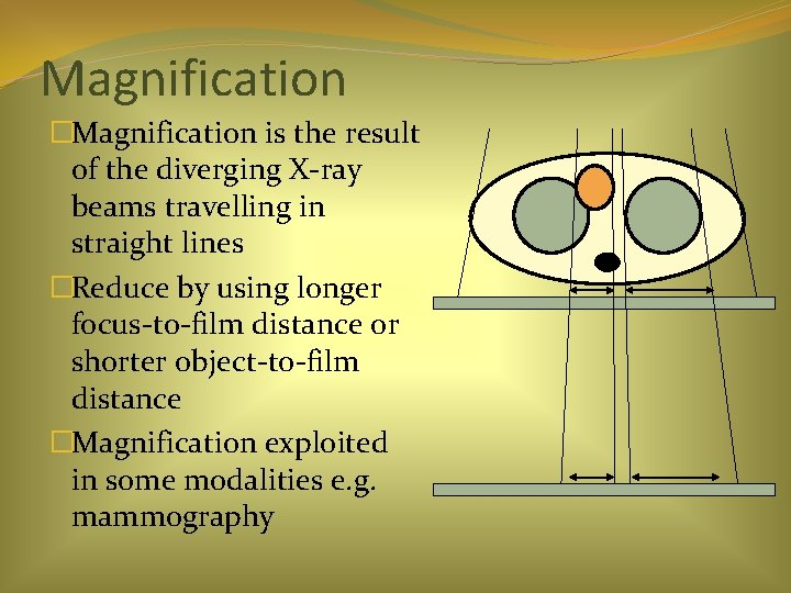 Magnification �Magnification is the result of the diverging X-ray beams travelling in straight lines