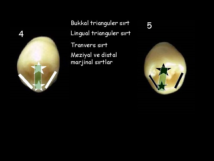 Bukkal trianguler sırt 4 Lingual trianguler sırt Tranvers sırt Meziyal ve distal marjinal sırtlar
