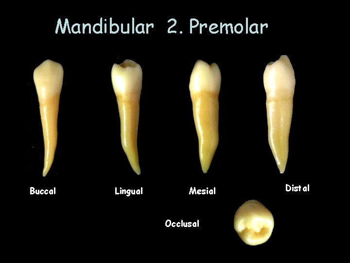 Mandibular 2. Premolar Buccal Lingual Mesial Occlusal Distal 
