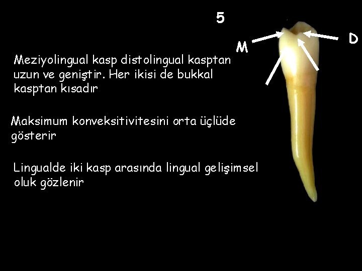 5 Meziyolingual kasp distolingual kasptan uzun ve geniştir. Her ikisi de bukkal kasptan kısadır