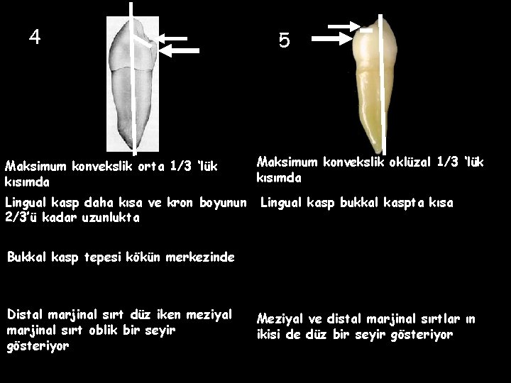 4 Maksimum konvekslik orta 1/3 ‘lük kısımda Lingual kasp daha kısa ve kron boyunun