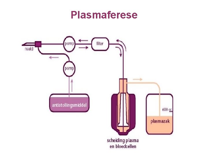 Plasmaferese 