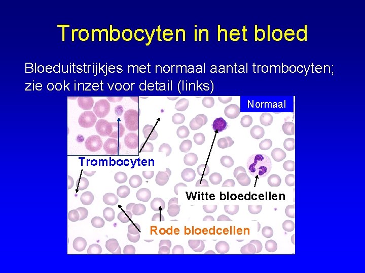 Trombocyten in het bloed Bloeduitstrijkjes met normaal aantal trombocyten; zie ook inzet voor detail