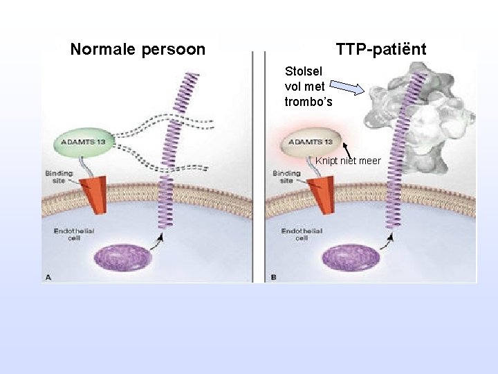 Normale persoon TTP-patiënt Stolsel vol met trombo’s Knipt niet meer 