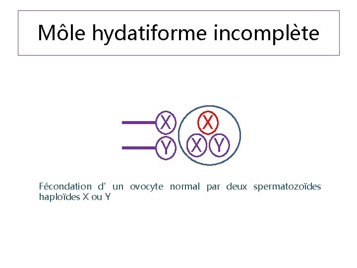 Môle hydatiforme incomplète X Y X X Y Fécondation d’un ovocyte normal par deux