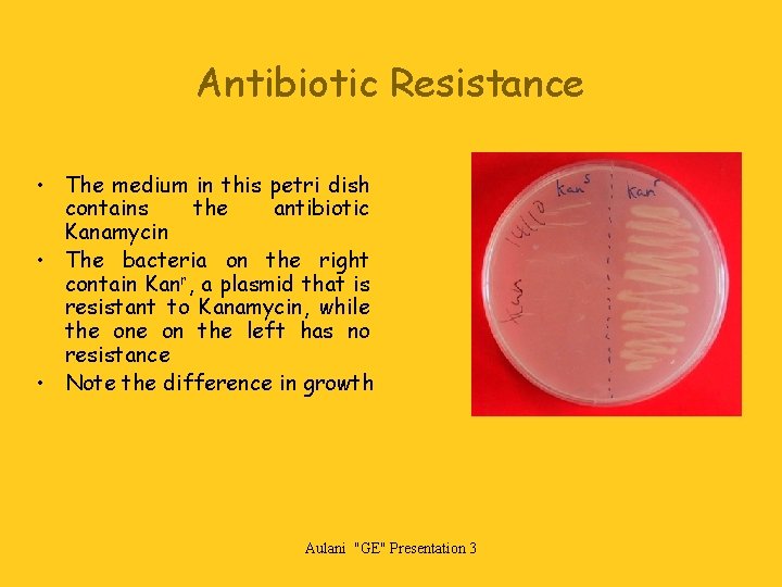 Antibiotic Resistance • The medium in this petri dish contains the antibiotic Kanamycin •