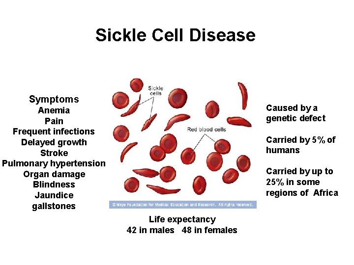Sickle Cell Disease Symptoms Caused by a genetic defect Anemia Pain Frequent infections Delayed