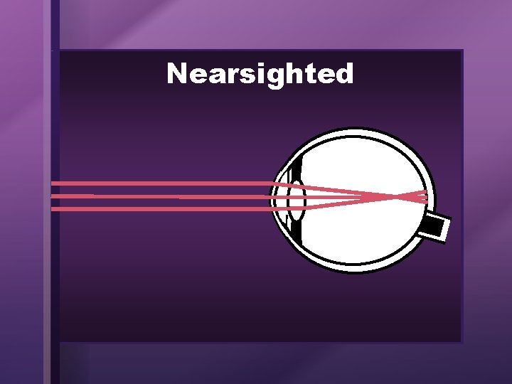 Nearsighted 