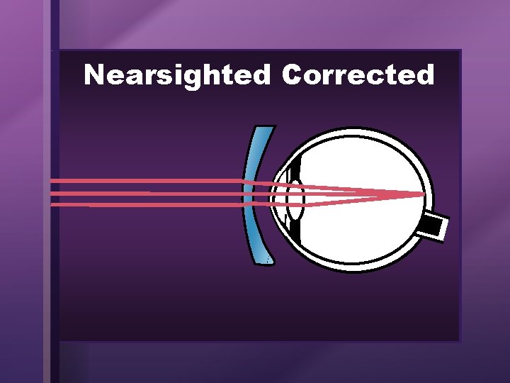 Nearsighted Corrected 