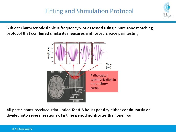 Fitting and Stimulation Protocol Subject characteristic tinnitus frequency was assessed using a pure tone