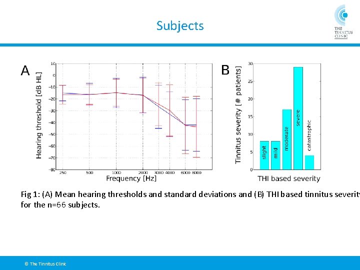 Subjects Fig 1: (A) Mean hearing thresholds and standard deviations and (B) THI based