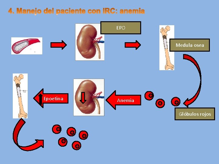 EPO Medula osea Epoetina Anemia Glóbulos rojos 