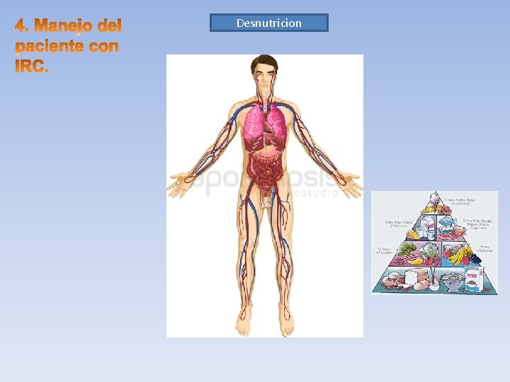 Desnutricion 