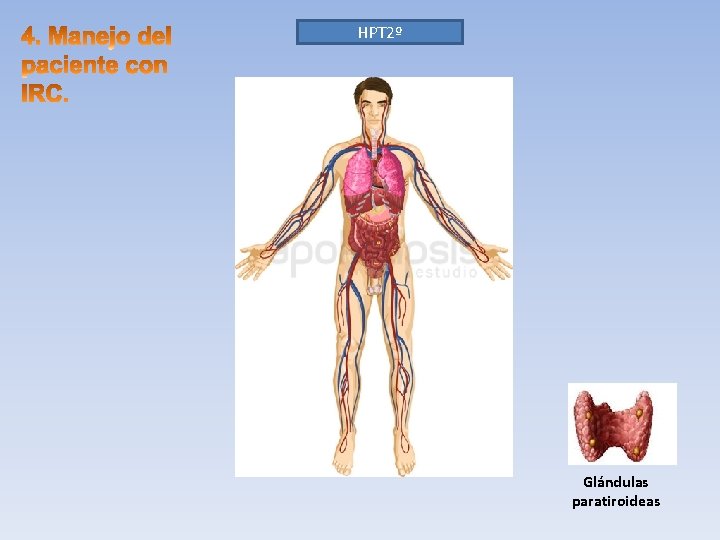 HPT 2º Glándulas paratiroideas 