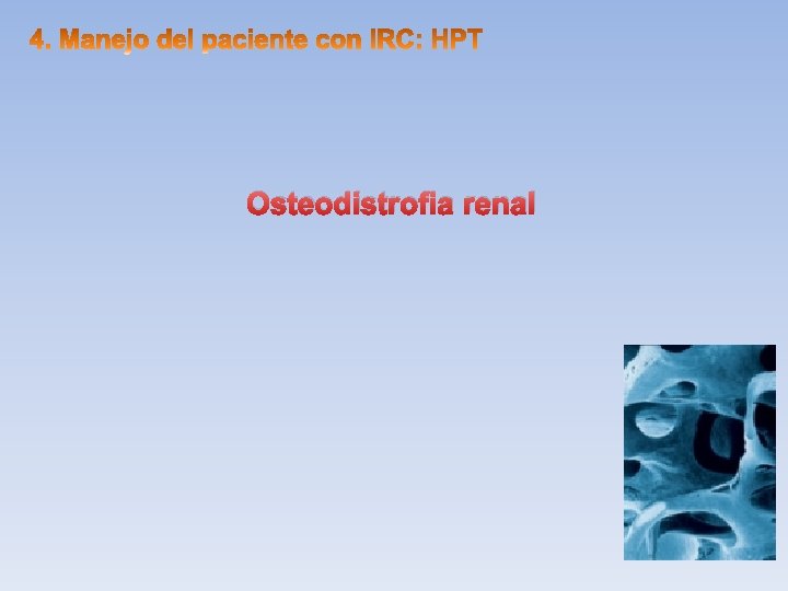 Osteodistrofia renal 