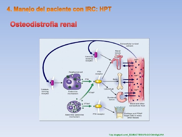 Osteodistrofia renal 1. bp. blogspot. com/_t 2 Ql 9 z. CTBGU/Sx. QOCMn. Gg. LI/AA