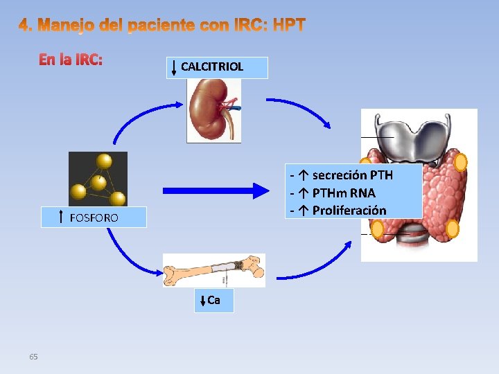 En la IRC: CALCITRIOL - ↑ secreción PTH - ↑ PTHm RNA - ↑