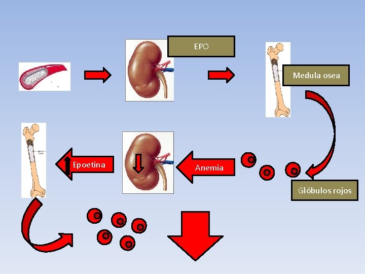 EPO Medula osea Epoetina Anemia Glóbulos rojos 