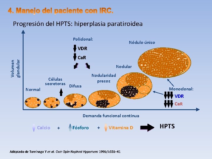Progresión del HPTS: hiperplasia paratiroidea Policlonal: Nódulo único VDR Volumen glandular Ca. R Nodular