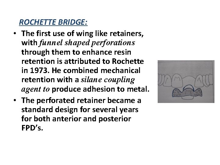 ROCHETTE BRIDGE: • The first use of wing like retainers, with funnel shaped perforations
