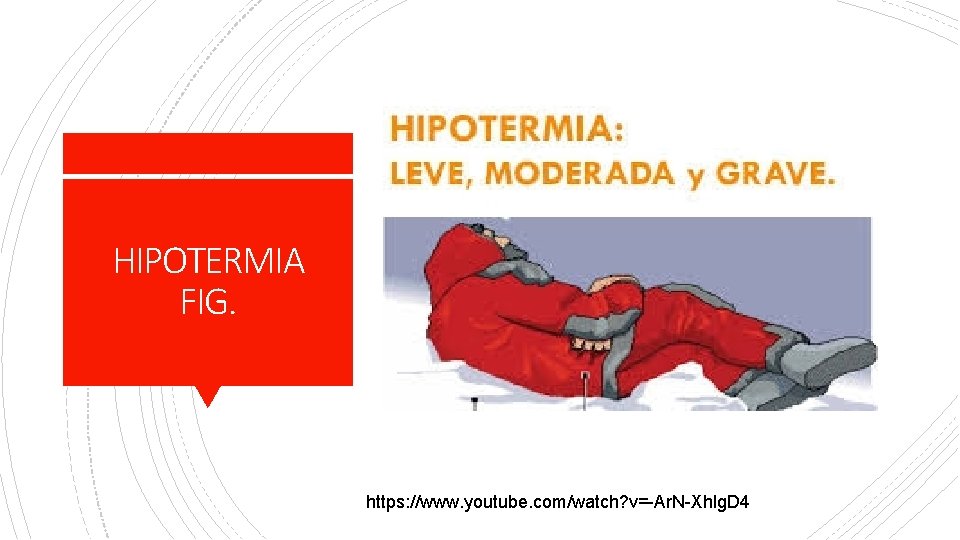 HIPOTERMIA FIG. https: //www. youtube. com/watch? v=-Ar. N-Xhlg. D 4 