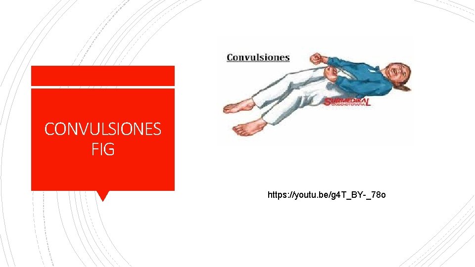 CONVULSIONES FIG https: //youtu. be/g 4 T_BY-_78 o 