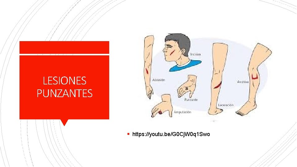 LESIONES PUNZANTES § https: //youtu. be/G 0 Cj. W 0 q 1 Swo 