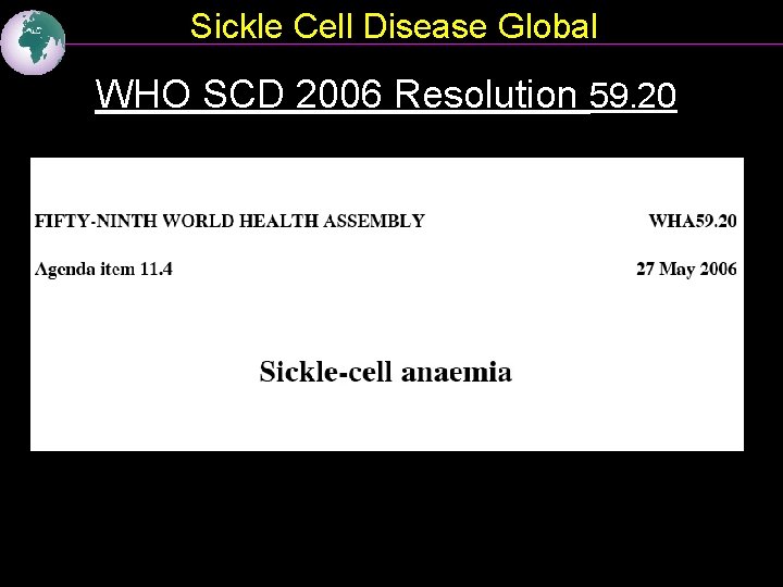 Sickle Cell Disease Global WHO SCD 2006 Resolution 59. 20 