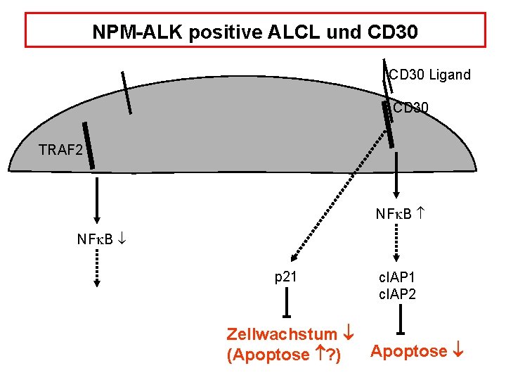 NPM-ALK positive ALCL und CD 30 Ligand CD 30 NPM ALK P CD 30