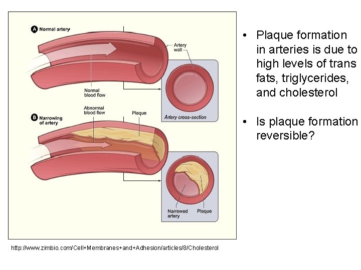  • Plaque formation in arteries is due to high levels of trans fats,