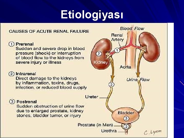 Etiologiyası 